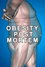 Watch Free Obesity: The Post Mortem (2016)